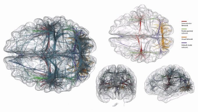 brain-connection-visualization