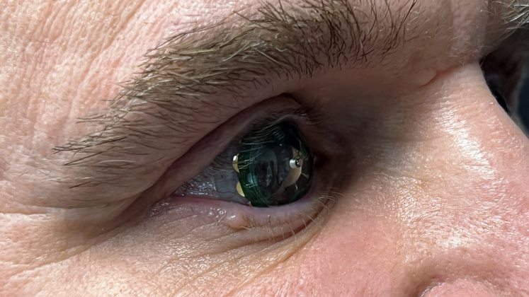 Mojo Vision's Smart Contact Lens Is Further Along Than You'd Think